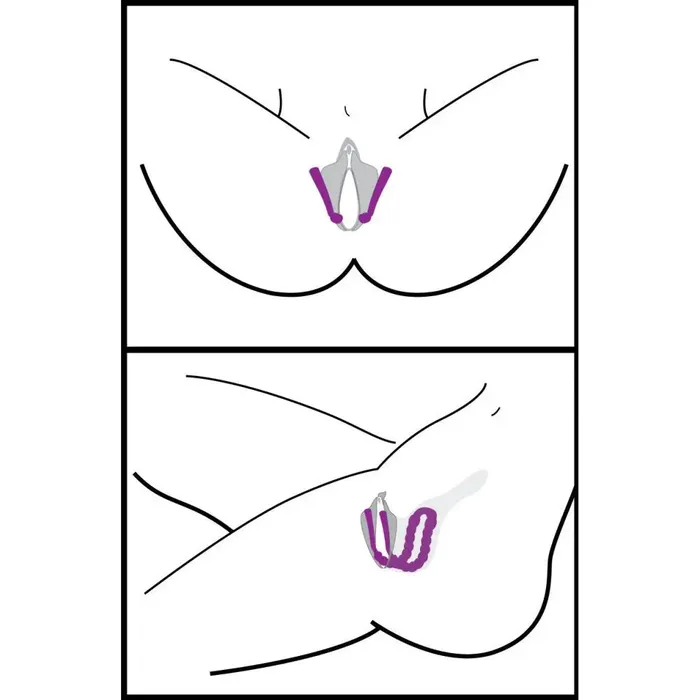 Vibrators Frisky Oral Enhancing Hands Free Labia Spreader Easy Clit Access Clit Isolation Vibrators Frisky Oral Enhancing Hands Free Labia Spreader Easy Clit Access Clit Isolation